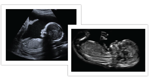Presentation Scan – Ultrasound Scan Clinic